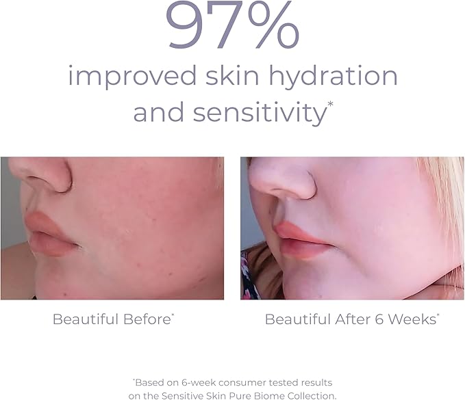 Derma-E Pure Biome Balancing Eye Cream for Women 14g